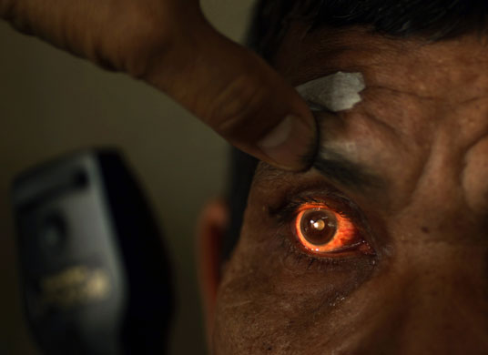 eye-examine-indonesia