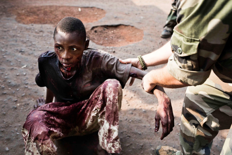 Central African Republic boy bleeding